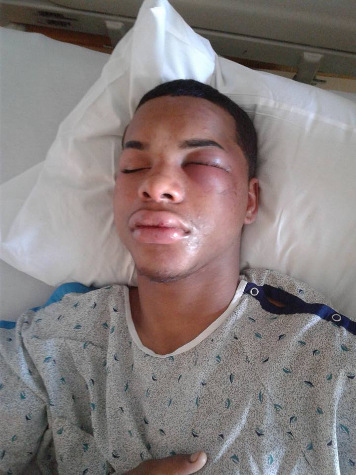 Carteret police beat teen